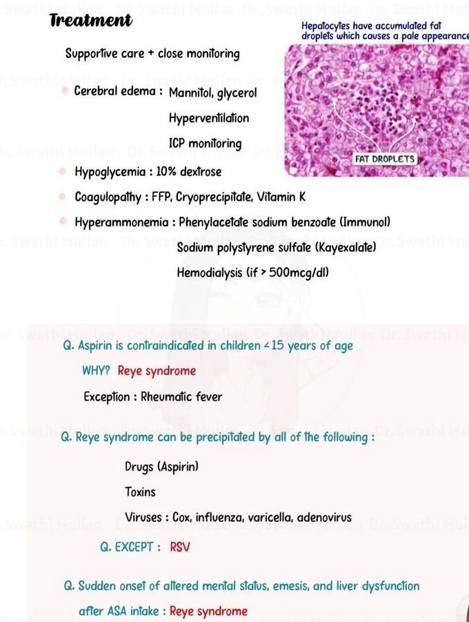 Reye Syndrome