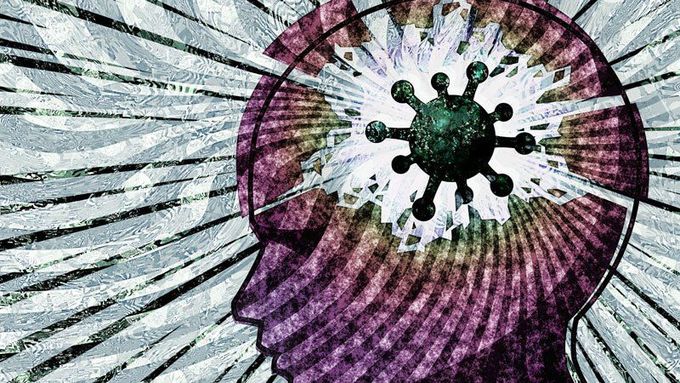 Profound Brain Changes Found in Patients Who Died of COVID-19
