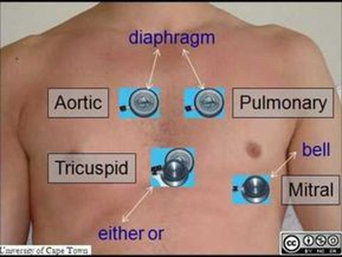 Ascultation for heart sound bell and diaphragm in - MEDizzy