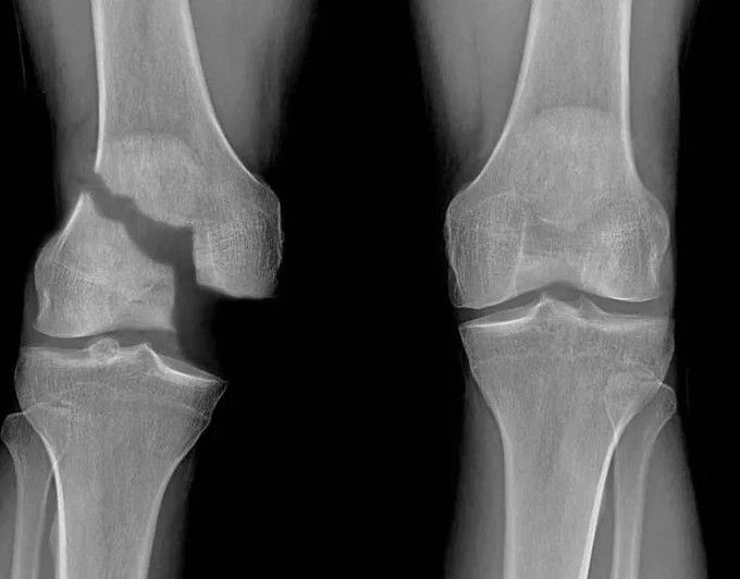 orthopedic surgery