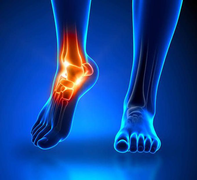 Prevention of ankle pain