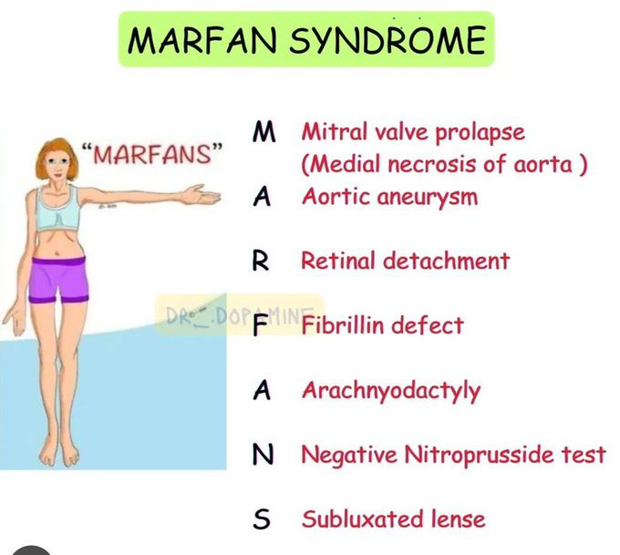 Marfan Syndrome