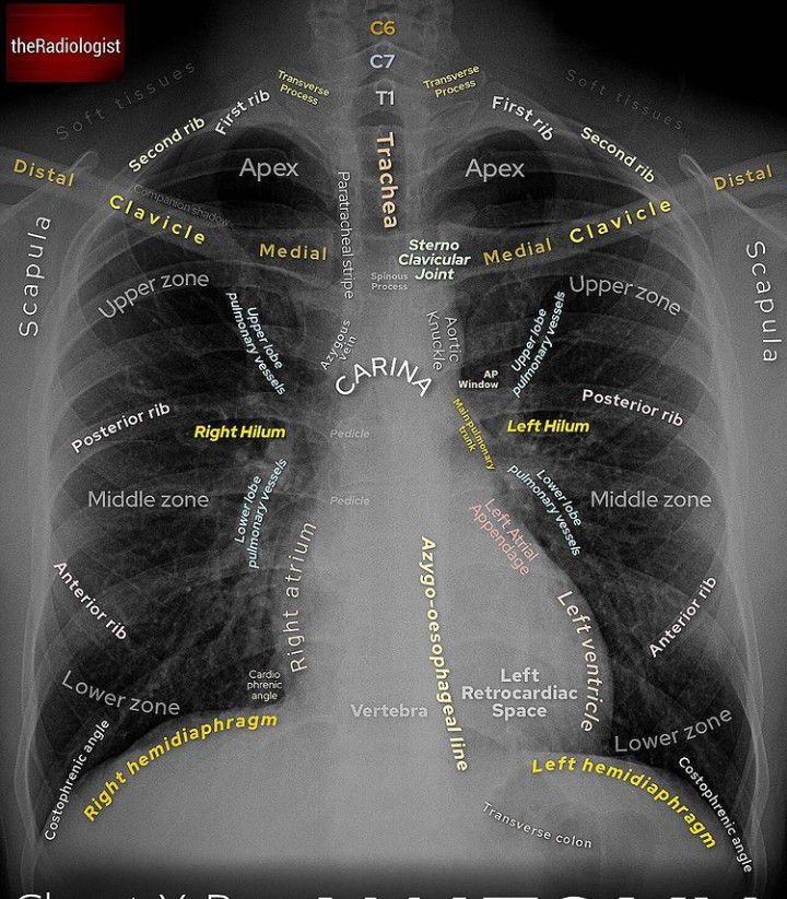 Anatomy of Chest Xray - MEDizzy