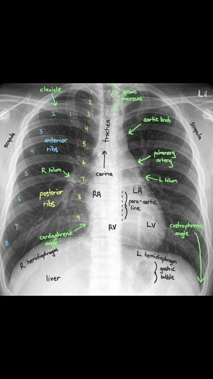 X ray - MEDizzy