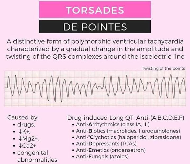 Ventricular Flutter Vs Torsades