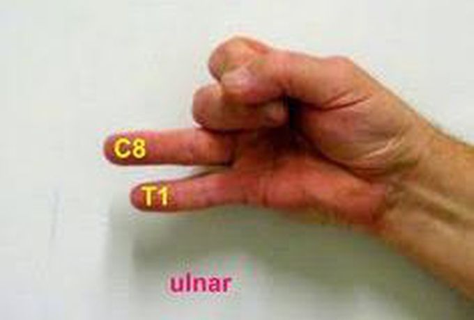 Ulnar nerve Root value