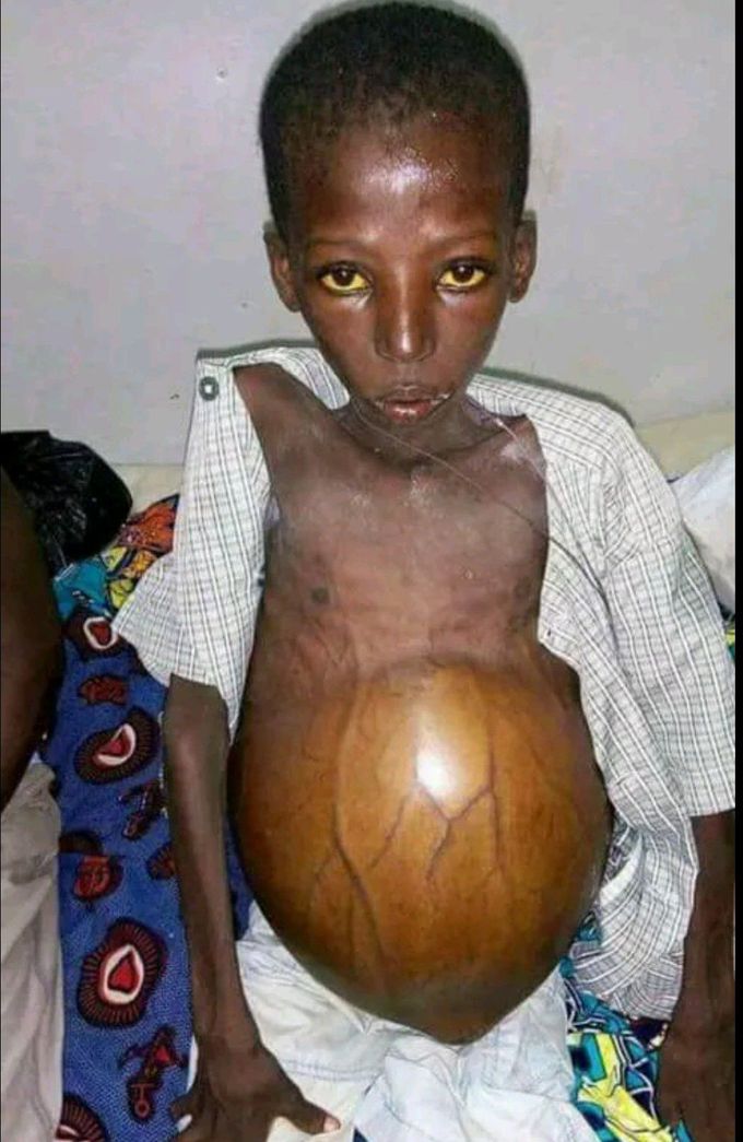 Diagnosis??