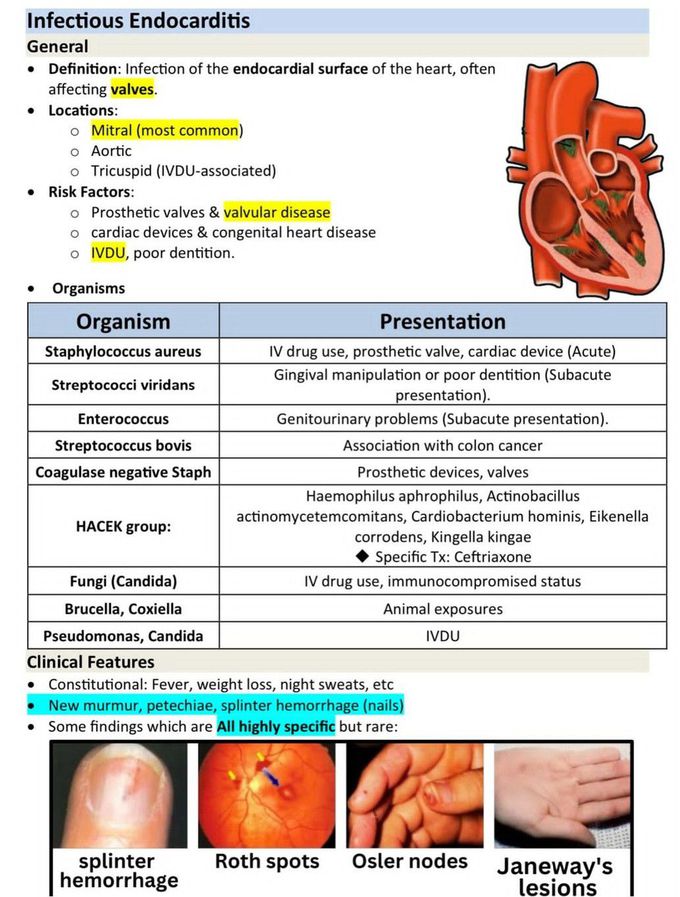 Infective Endocarditis