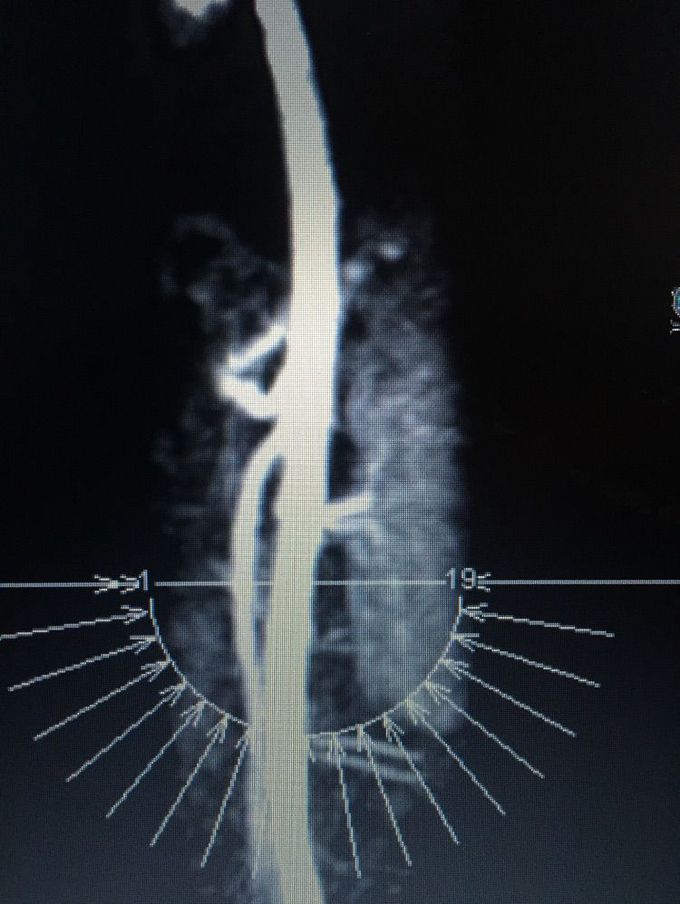What does this MRI image portray?