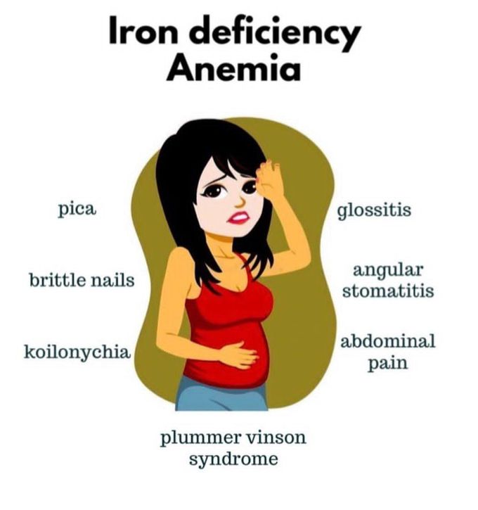 Iron Deficiency Anemia Medizzy 3490