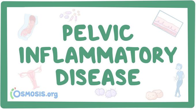 Pelvic Inflammatory Disease