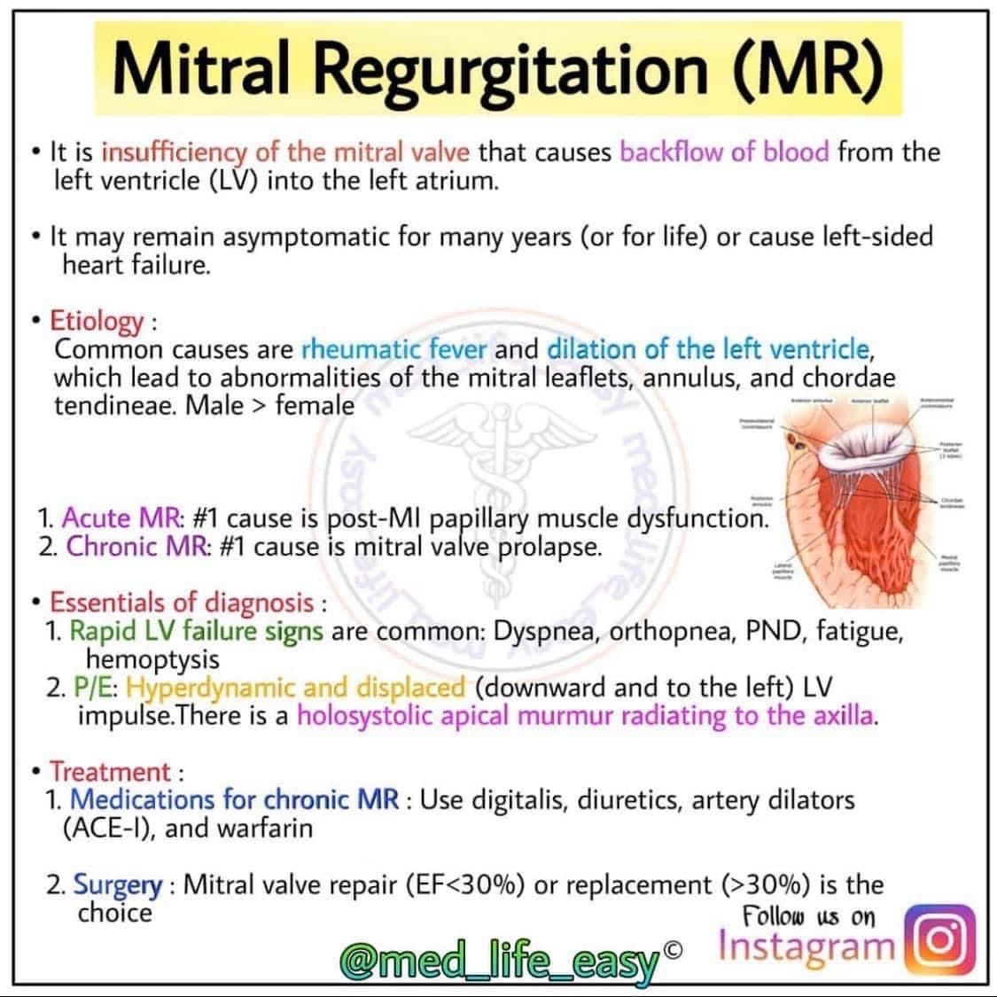 Most Common Treatment For Mitral Regurgitation