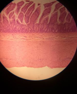 Smooth muscle - MEDizzy