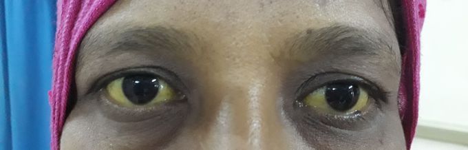 What's the diagnosis??