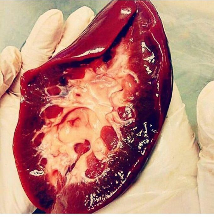 Kidneyy!!