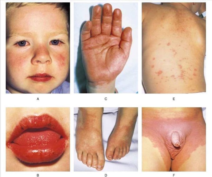 Diagnose the patient?