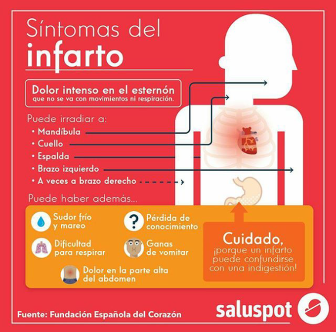 Ataque al miocardio / infarction to the myocardium