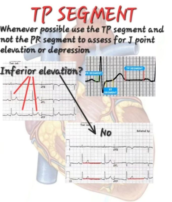 TP Segment