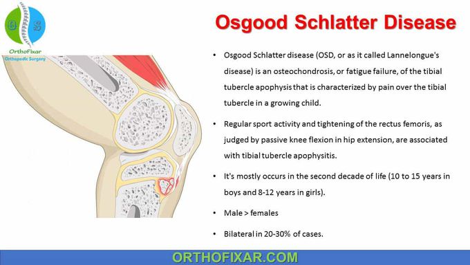 Osgood Schlatter Disease - Full Detailed - OrthoFixar 2022