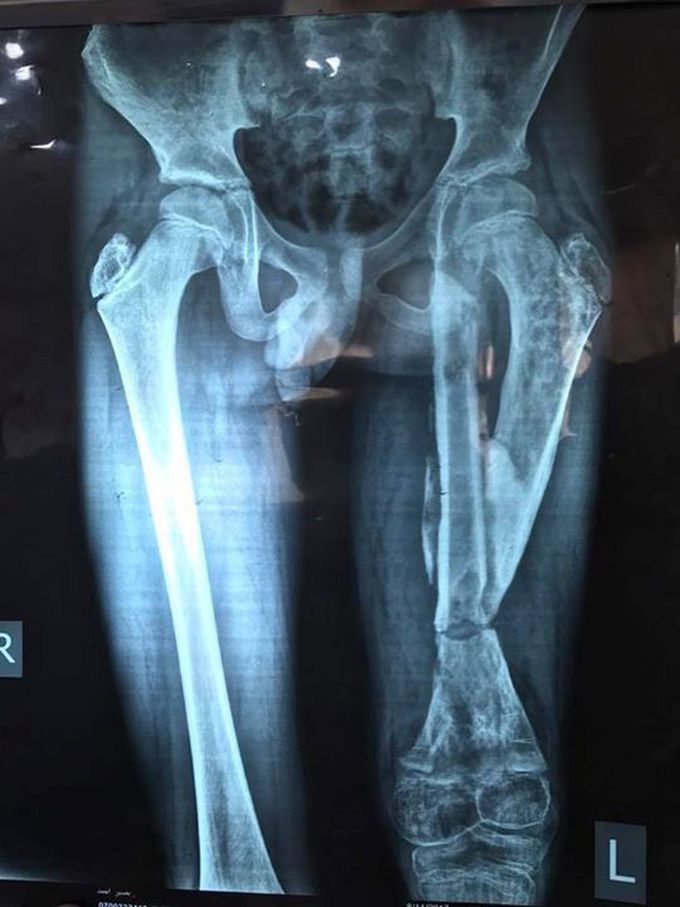 Orthopedics