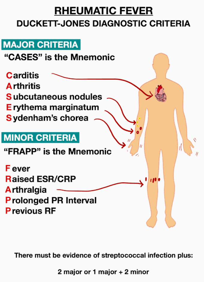 Rheumatic fever MEDizzy