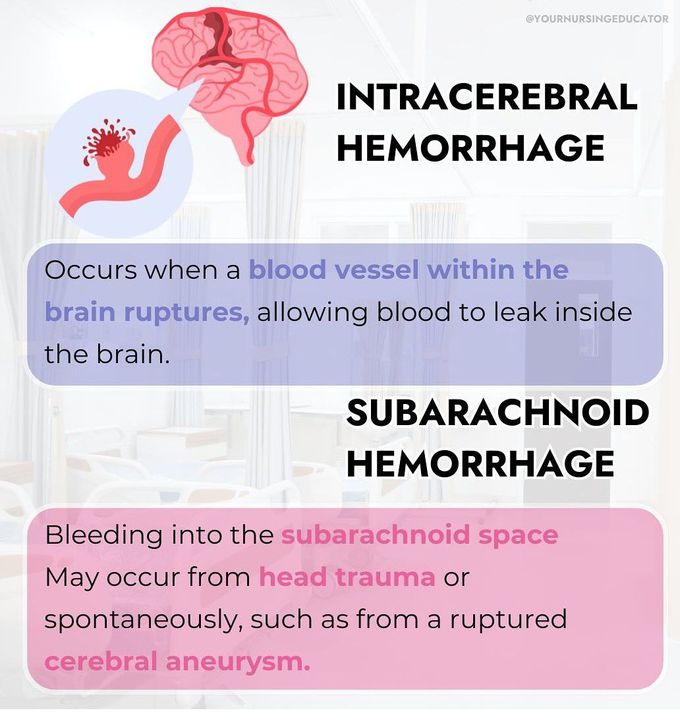 Intracerebral Hemorrhage