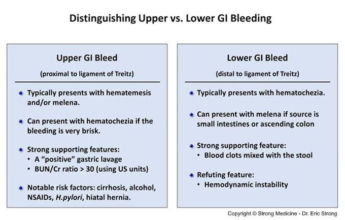 Upper Vs lower GI bleeding
