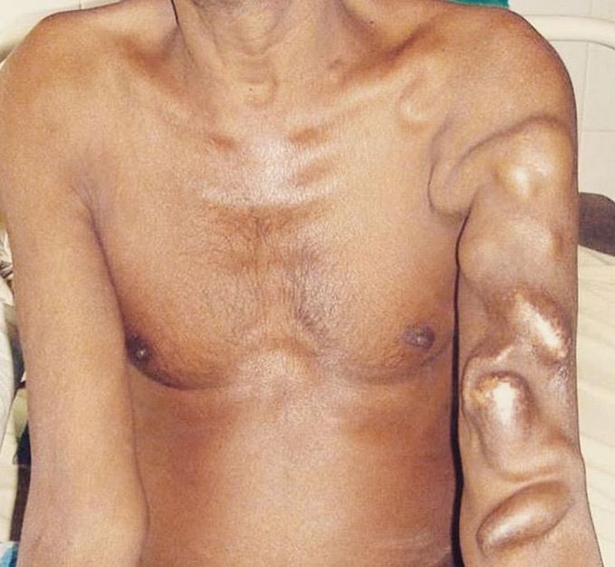 What is your diagnosis?