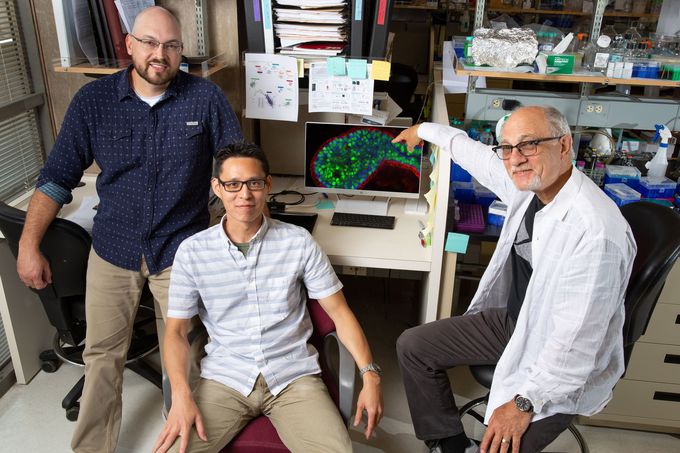 A master switch controls Aggressive Breast Cancer