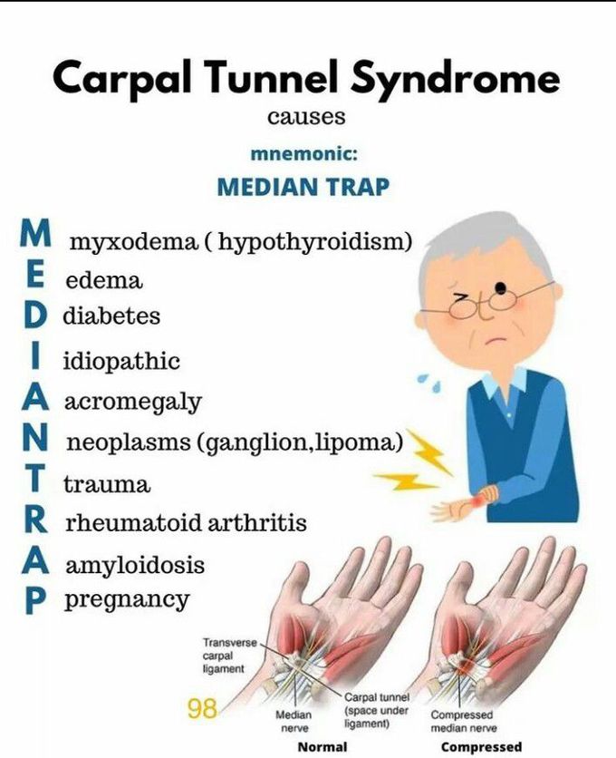 Carpal Tunnel Syndrome