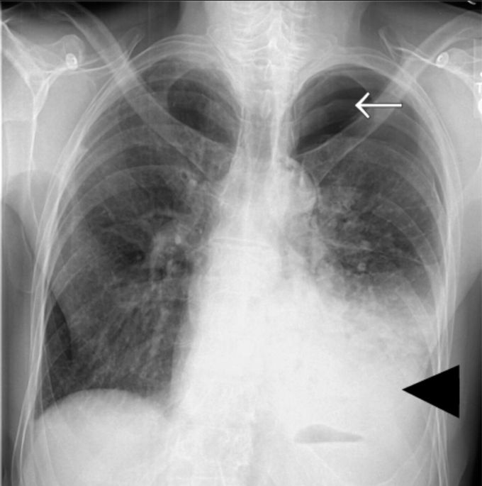 🔻Radiology quiz🔻