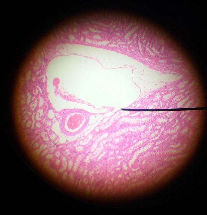 Slide of kidney showing glomerulus and bowman capsule