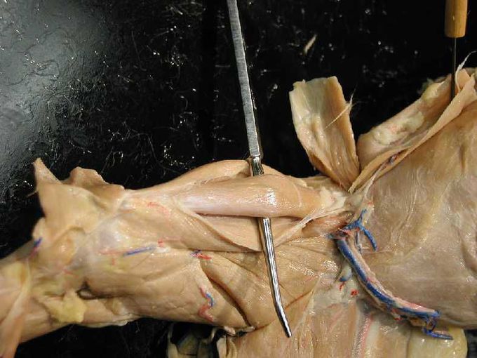 Anatomy OF RECTUS FEMORIS MUSCLE