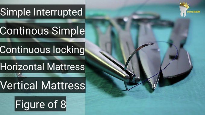 6 Types of Suturing Techniques