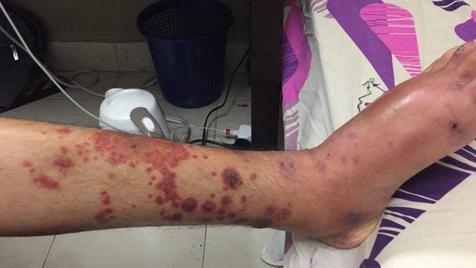 Diagnosis?