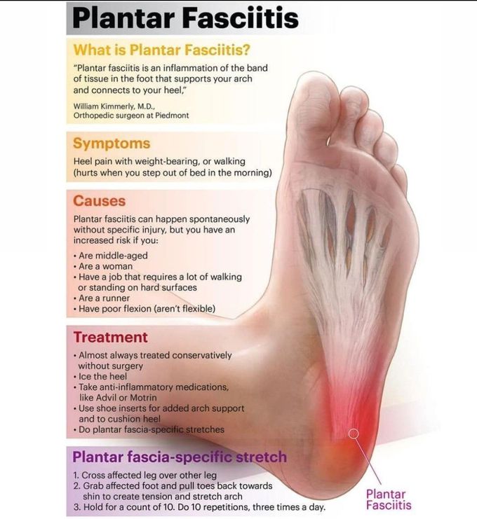 What is plantar fascitis???