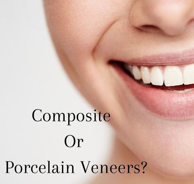 Composite Vs Porcelain Veneers