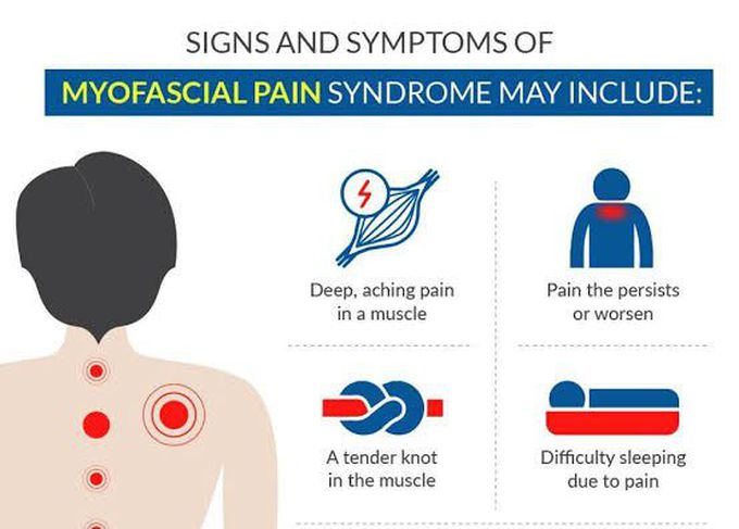 These are the symptoms of Myofascial pain syndrome