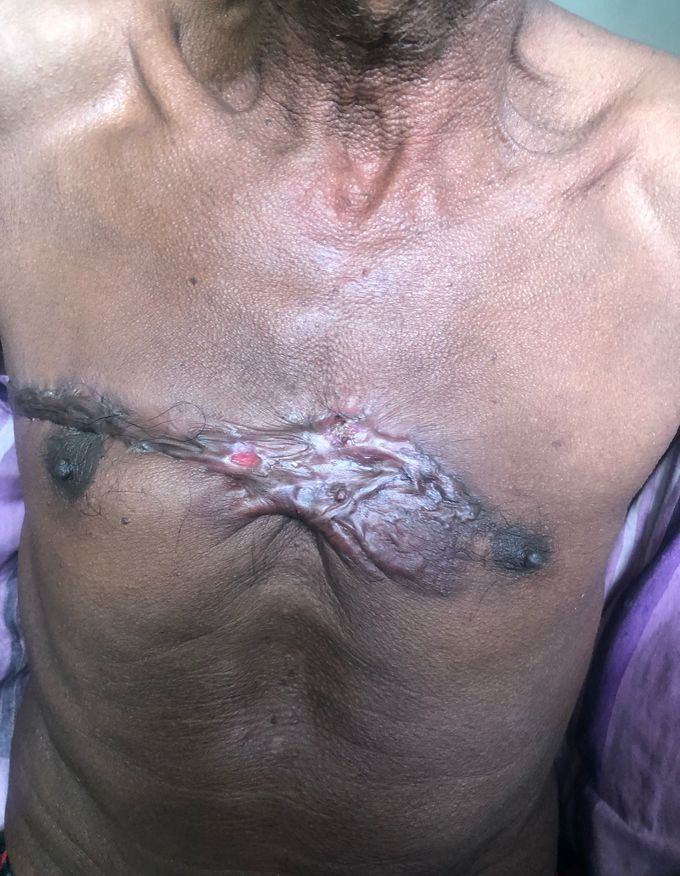 Spot Diagnosis