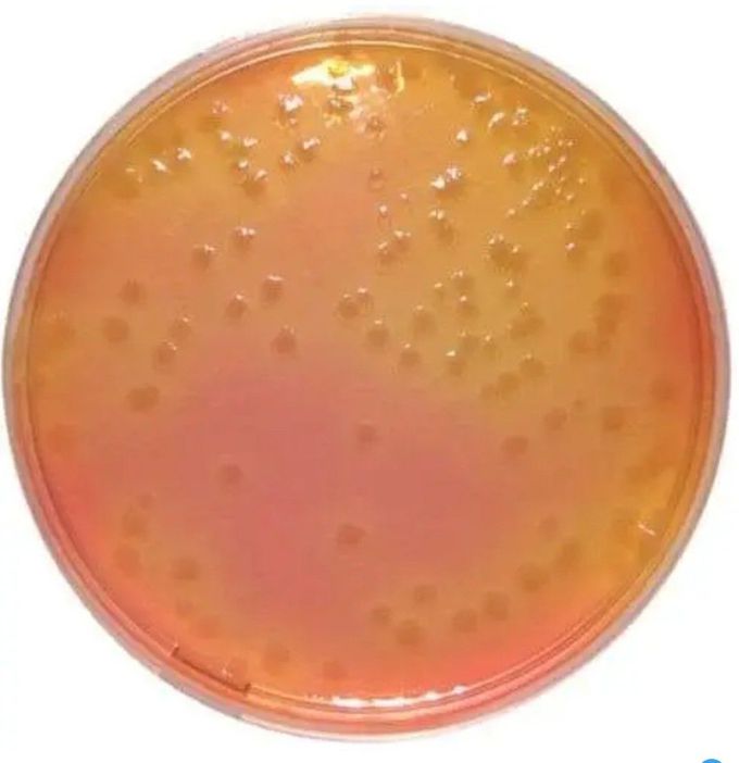 Salmonella Shigella agar (S.S.A)