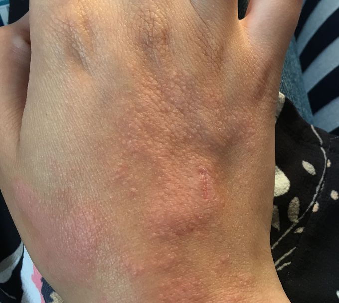 what is your diagnosis?