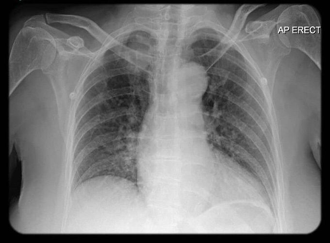 Whats your diagnosis??