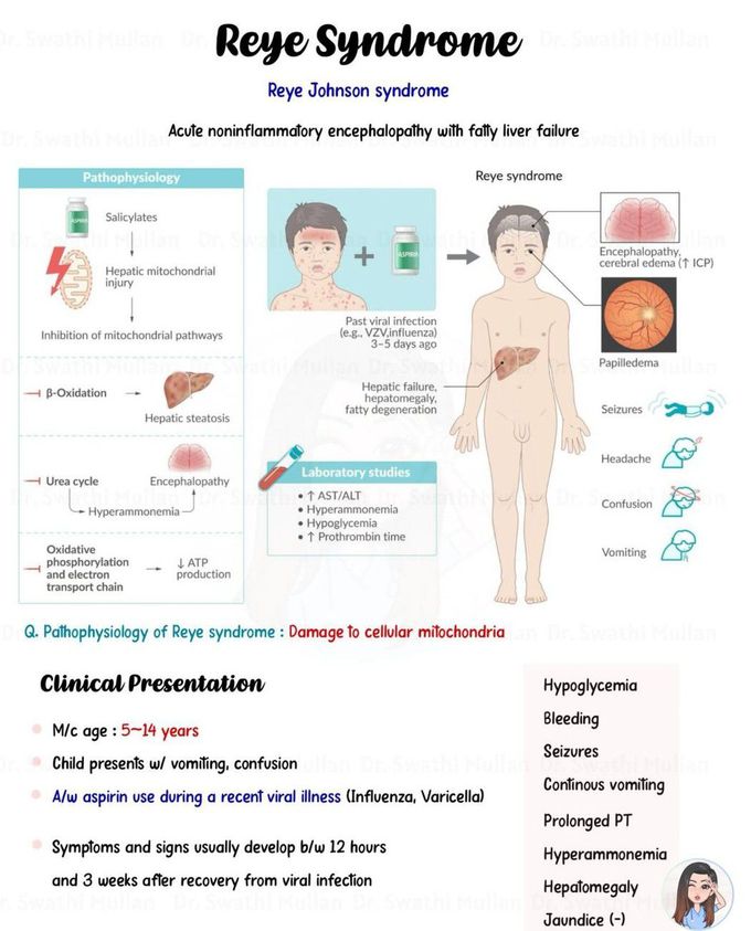 Reye Syndrome