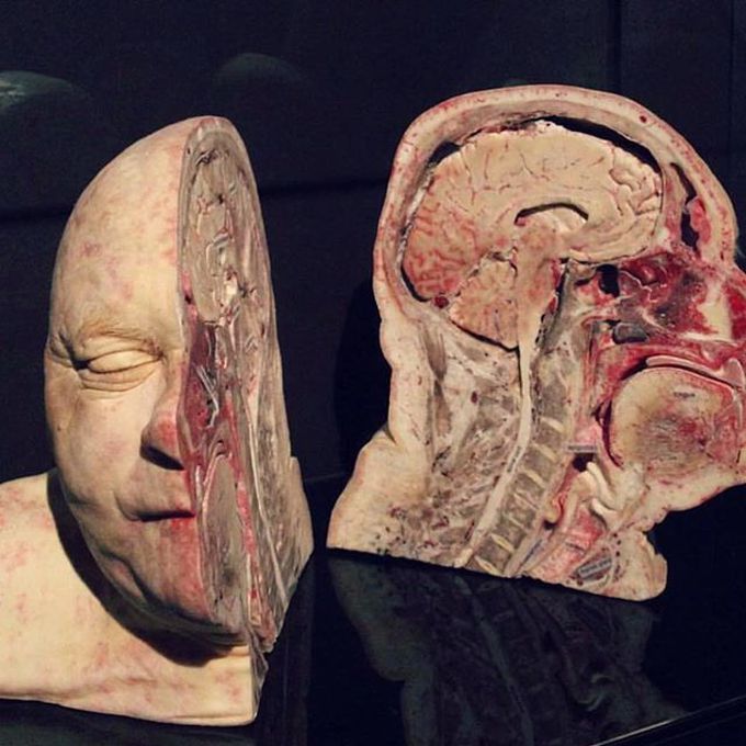 Now this is a neat dissection!