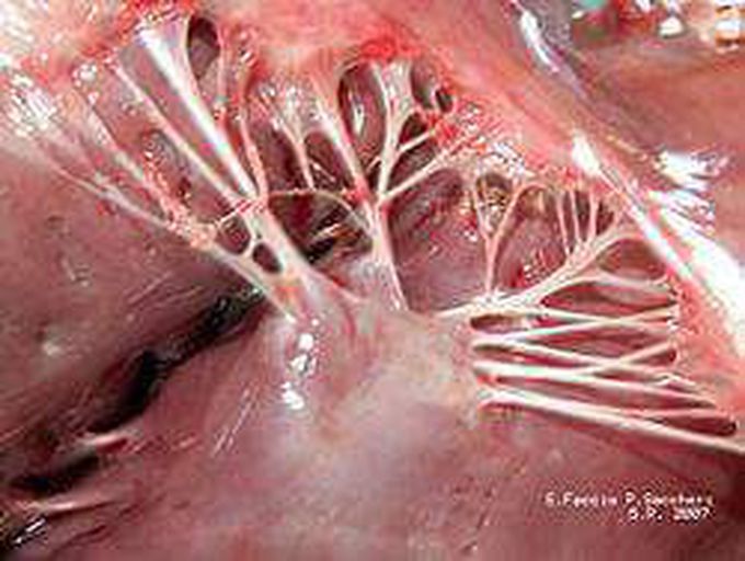 Chlordae tendineae