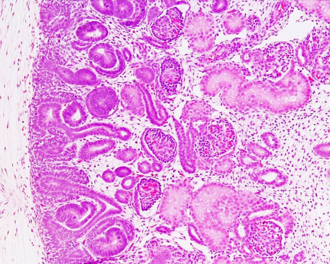 Human fetal kidney histology