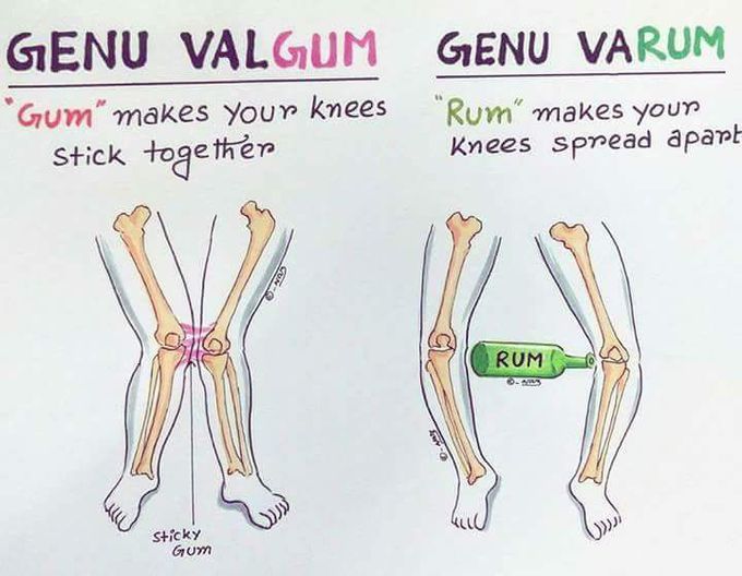 Defects of lower limb