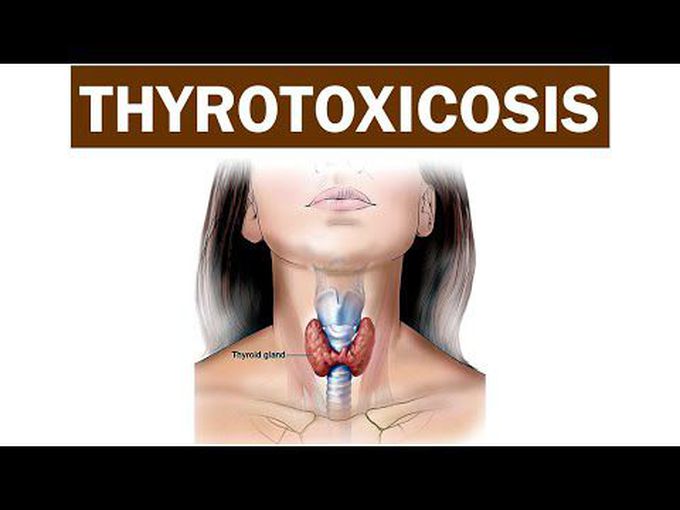 What is Thyrotoxicosis? - Descriptive