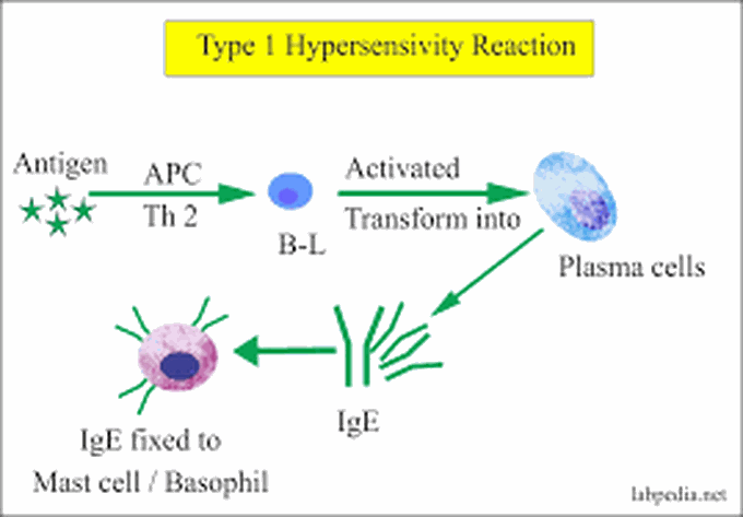 Type 1 hypersensitivity