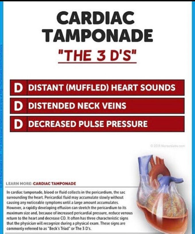 Cardiac Temponade